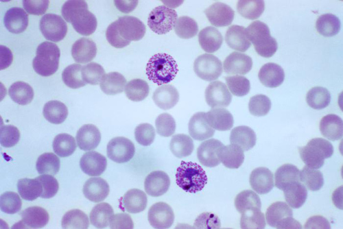 Plasmodium