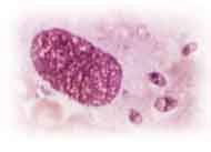 Mycobacterium tuberculosis